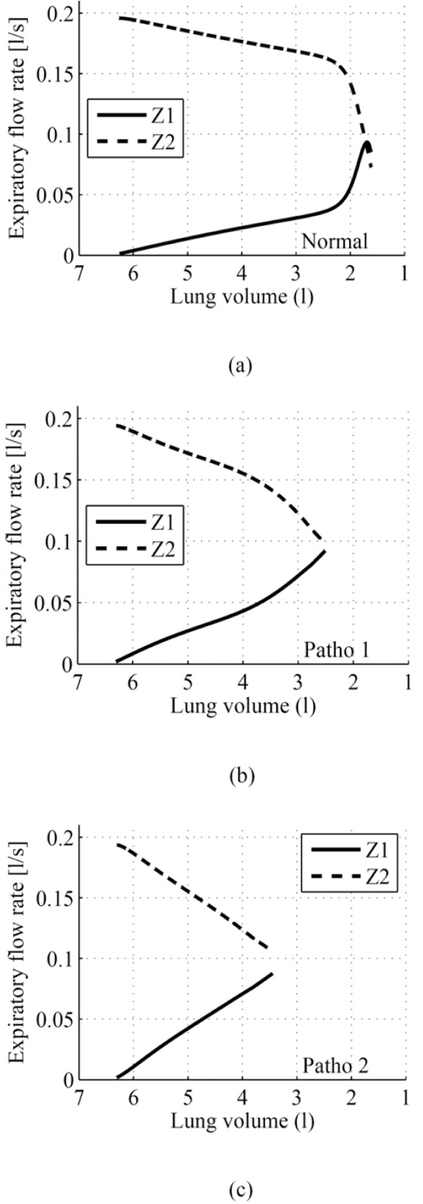A Functional Mathematical Model to Simulate the SingleBreath Nitrogen