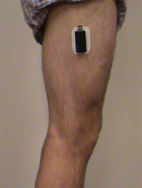 Accelerometerbased Physical Activity Monitoring in Patients with Knee