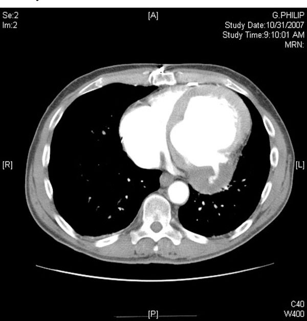 Ct scan iv trading system