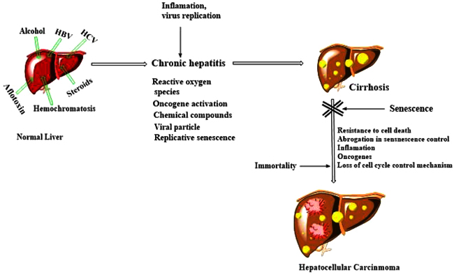 hepatic cancer and hepatitis