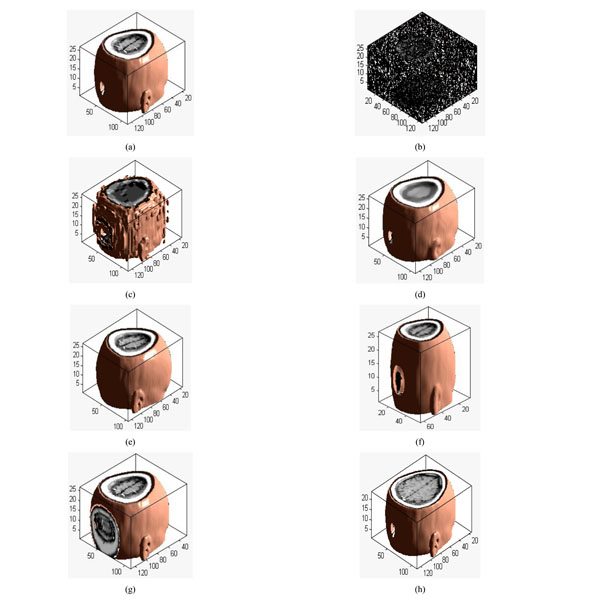 3D DWT-DCT And Logistic MAP Based Robust Watermarking For Medical ...