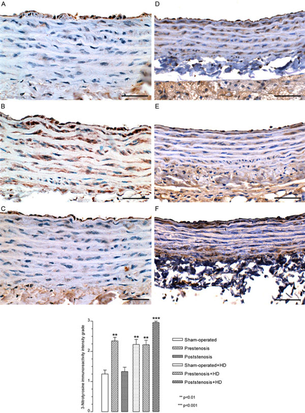 Aorta Remodeling Responses to Distinct Atherogenic Stimuli: Hyperten ...