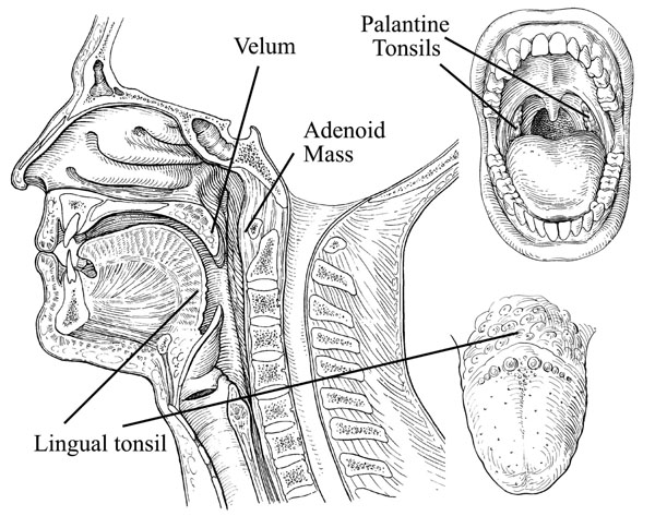 lingual tonsil model