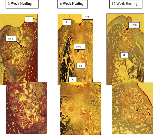 Clinical And Histological Comparison Of Extraction Socket Healing ...