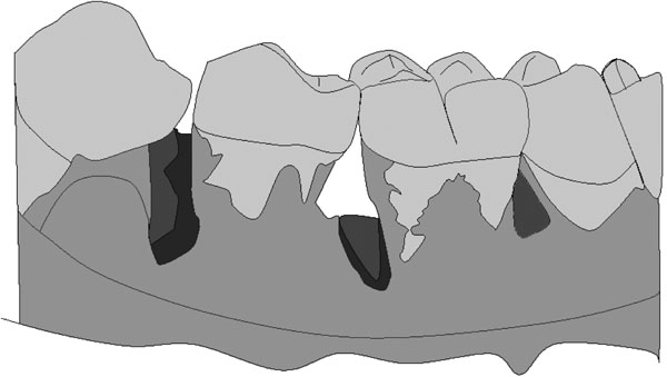 experimental animal models in periodontology a review