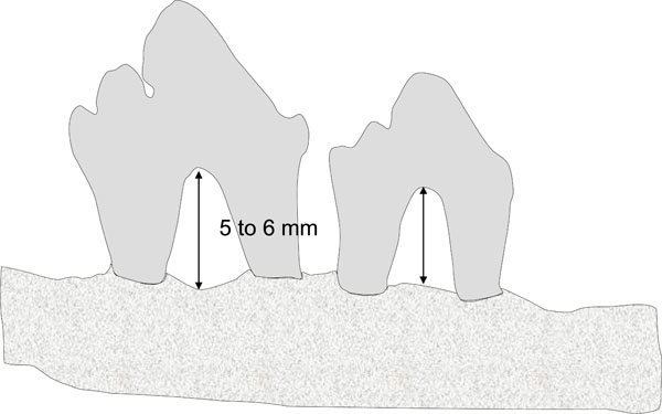 experimental animal models in periodontology a review