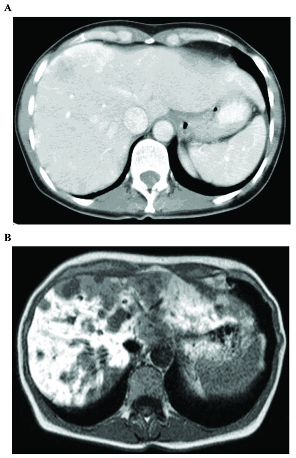 mr contrast agents radiology