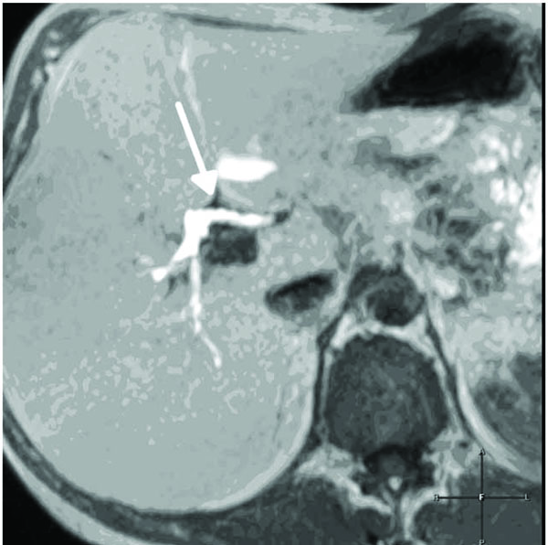 mr contrast agents act principally through changing