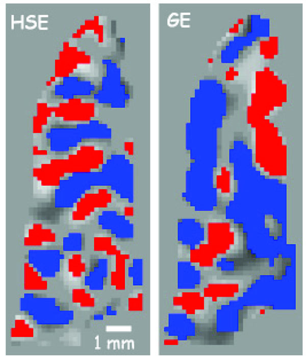 High-Field fMRI for Human Applications: An Overview of Spatial ...