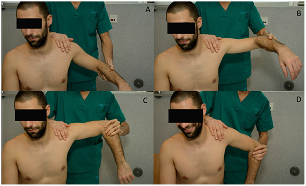 Physical Exam And Evaluation Of The Unstable Shoulder Fulltext