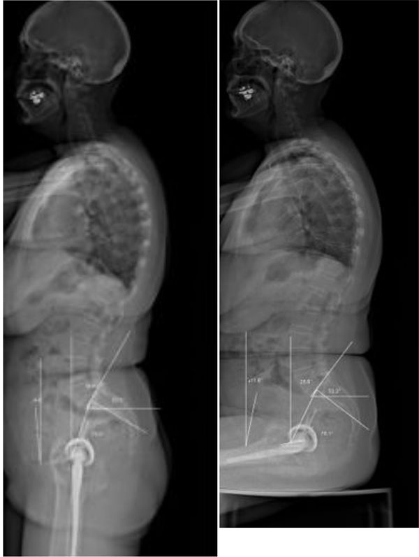 TEOFT on X: STANDING  / X